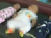 Maminka porodila trojčata, ale jedno miminko bylo úplně jiné než ostatní! Nic takového lékaři ještě neviděli!